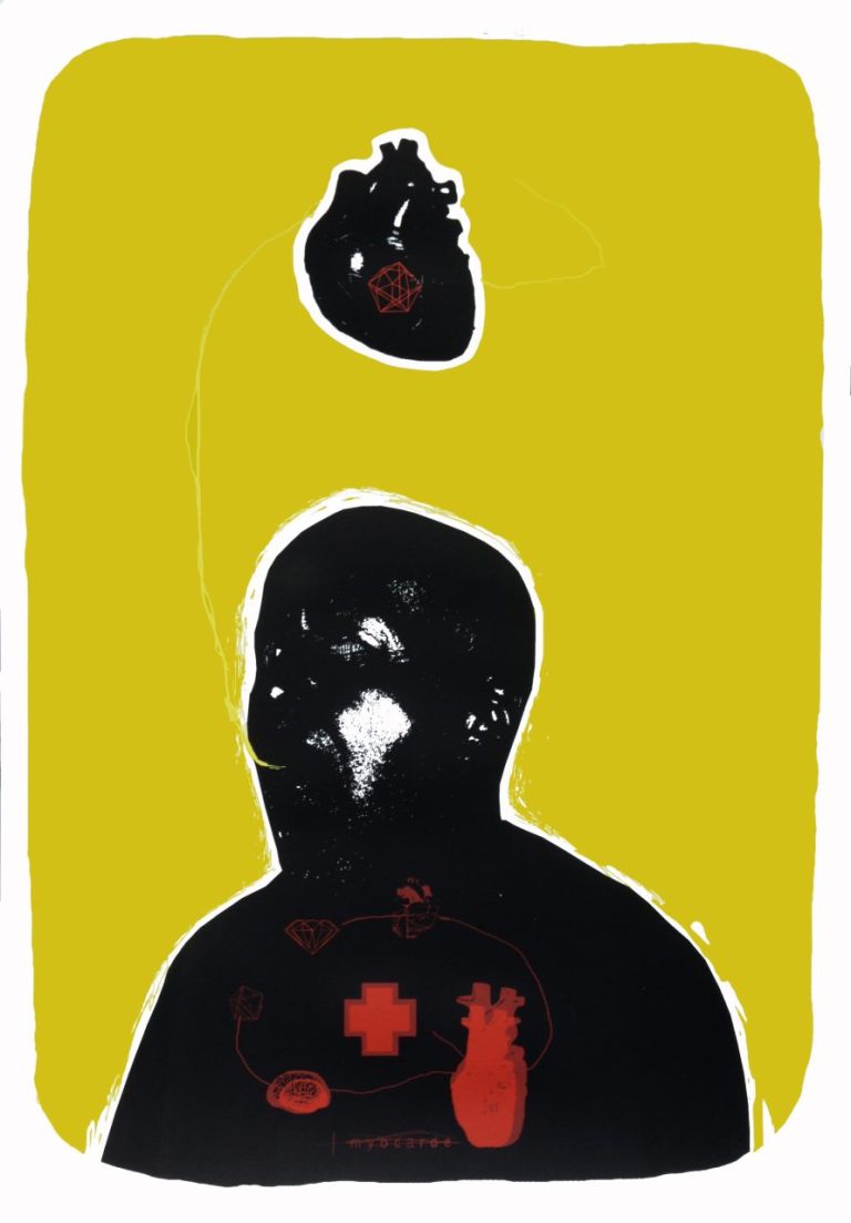 Myocarde, 50 X 70 Cm, Estampe Sérigraphiée 5 Couleurs, 30 Exemplaires, 2014